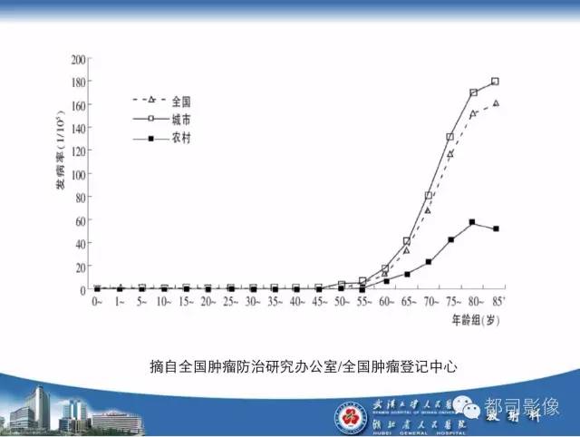 【PPT】前列腺癌高分辨率DWI临床应用