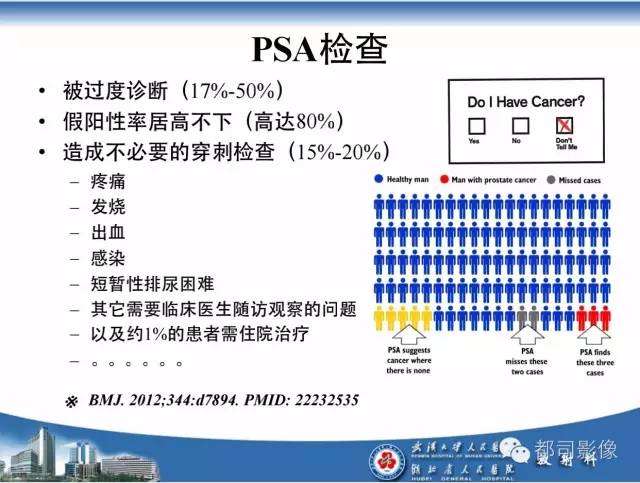 【PPT】前列腺癌高分辨率DWI临床应用