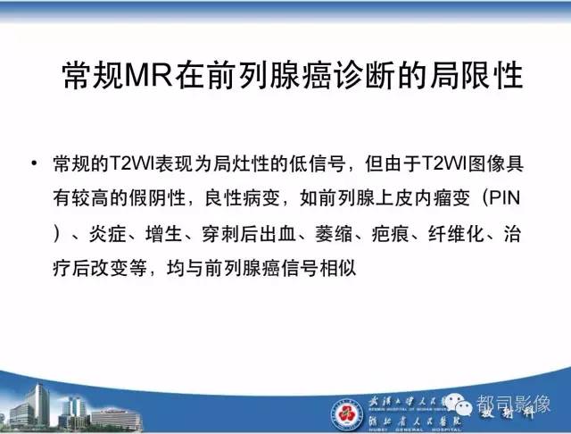 【PPT】前列腺癌高分辨率DWI临床应用