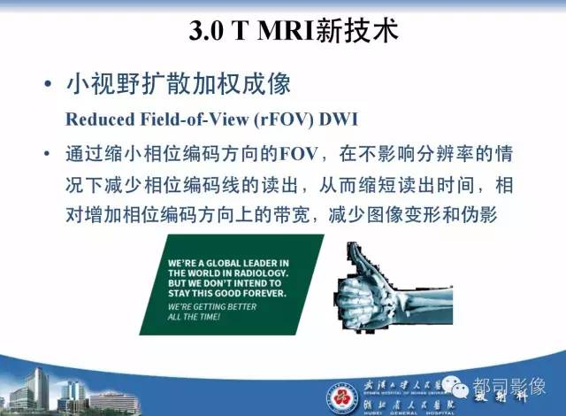 【PPT】前列腺癌高分辨率DWI临床应用