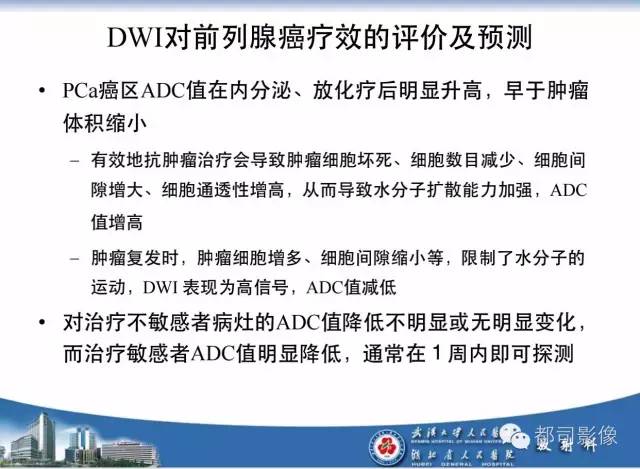 【PPT】前列腺癌高分辨率DWI临床应用