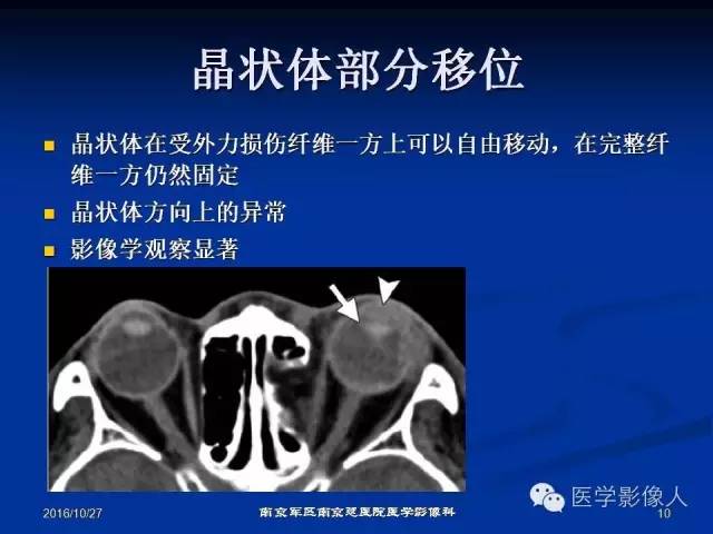 【PPT】眼外伤影像学表现【RG精选】