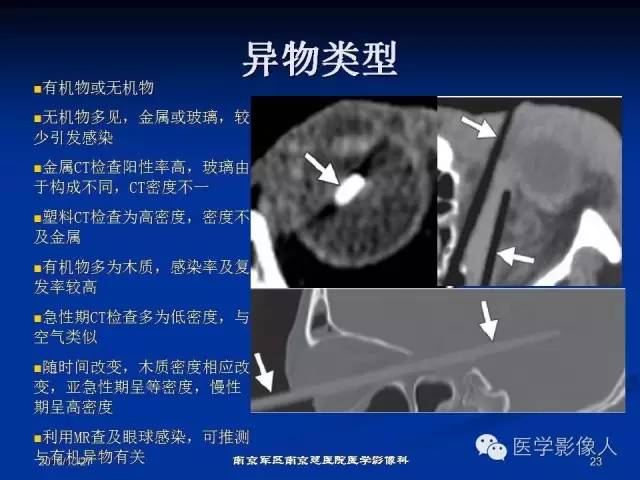 【PPT】眼外伤影像学表现【RG精选】