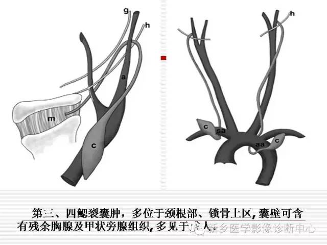 【病例】第一鳃裂囊肿1例CT,附四种类型的鉴别要点 【病例】第一鳃裂囊肿1例CT,附四种类型的鉴别要点
