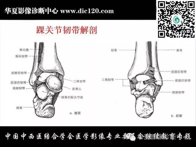 【PPT】踝关节外伤及先天性病变的影像诊断