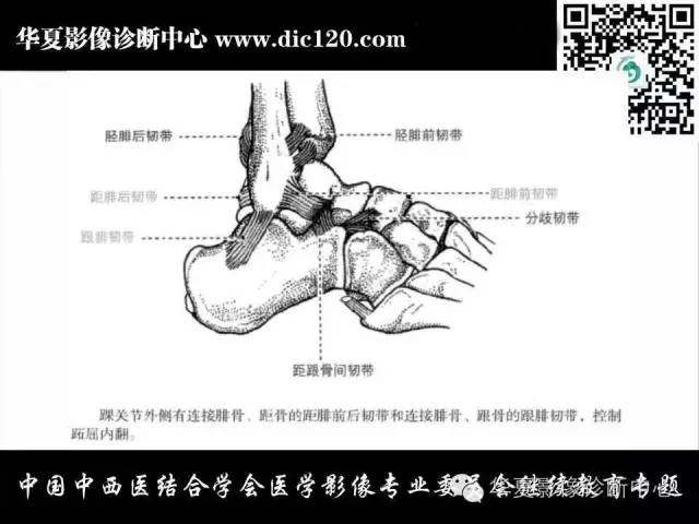 【PPT】踝关节外伤及先天性病变的影像诊断