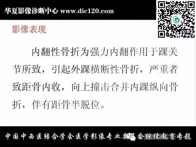 【PPT】踝关节外伤及先天性病变的影像诊断