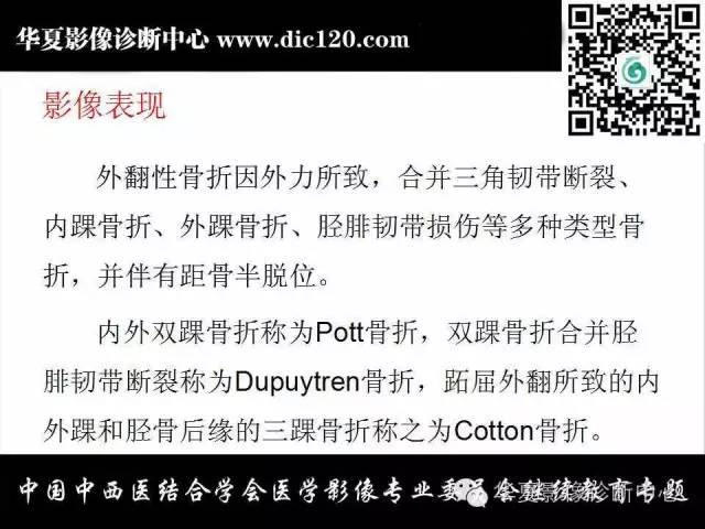 【PPT】踝关节外伤及先天性病变的影像诊断