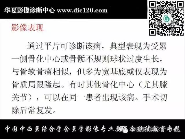 【PPT】踝关节外伤及先天性病变的影像诊断