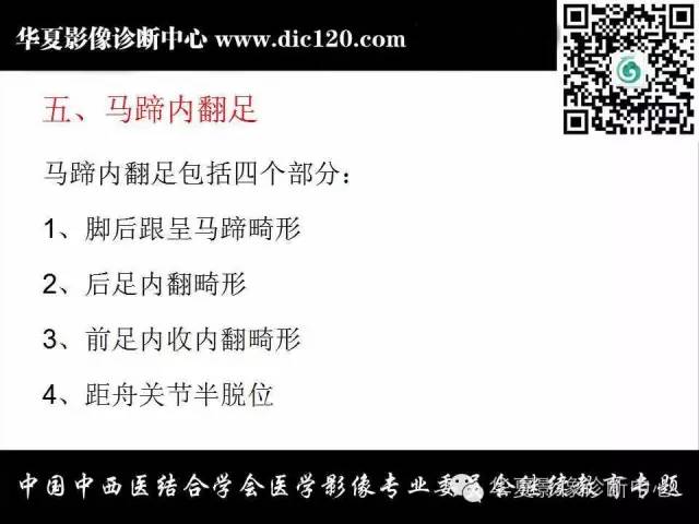 【PPT】踝关节外伤及先天性病变的影像诊断