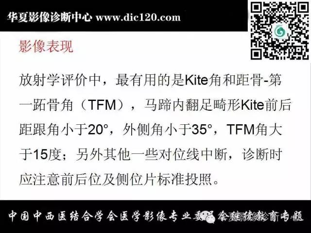 【PPT】踝关节外伤及先天性病变的影像诊断