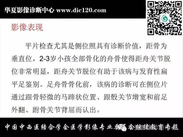 【PPT】踝关节外伤及先天性病变的影像诊断