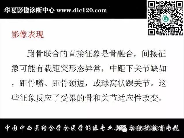 【PPT】踝关节外伤及先天性病变的影像诊断