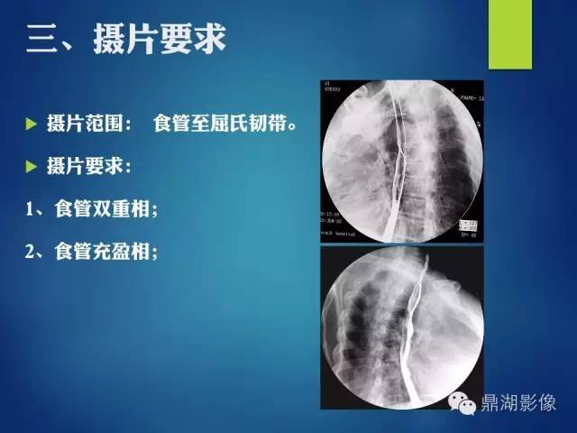 【PPT】上消化道钡剂造影摄片标准