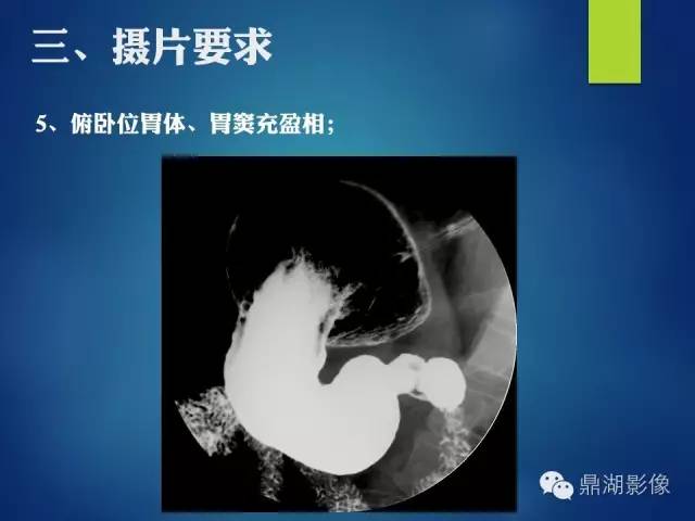 【PPT】上消化道钡剂造影摄片标准