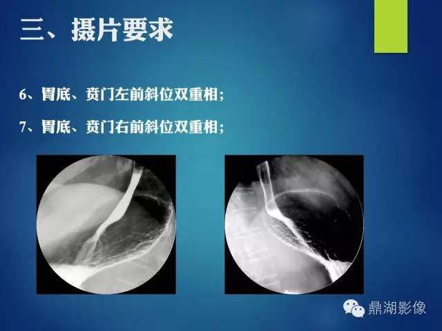 【PPT】上消化道钡剂造影摄片标准