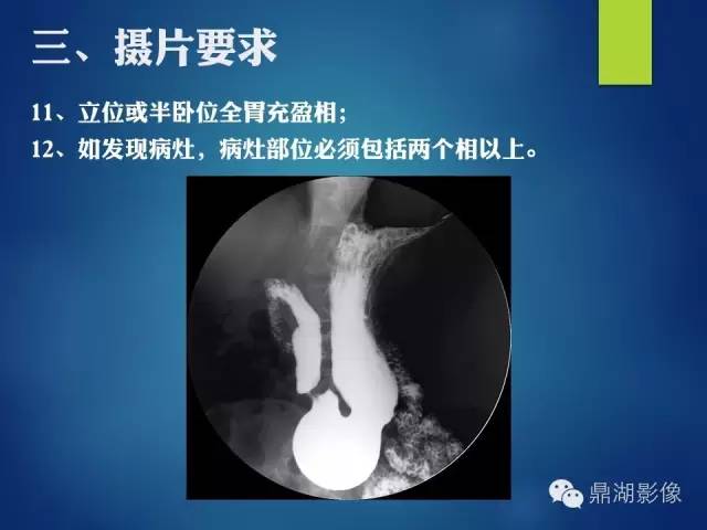 【PPT】上消化道钡剂造影摄片标准