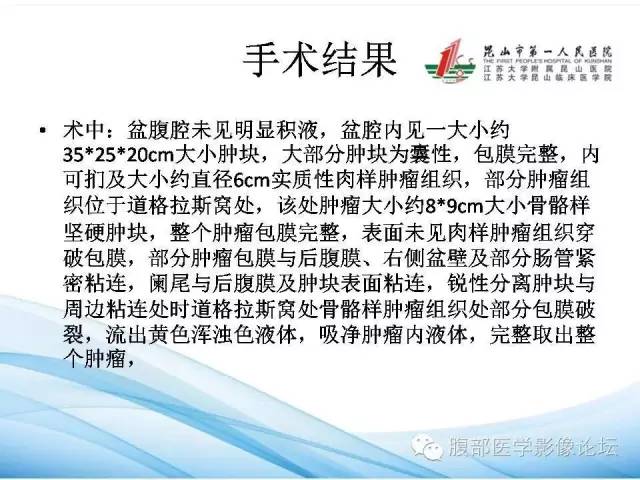 【病例】卵巢透明细胞腺癌1例CT影像表现