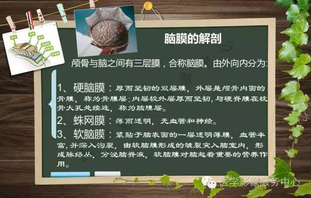 【PPT】蛛网膜颗粒的影像学表现