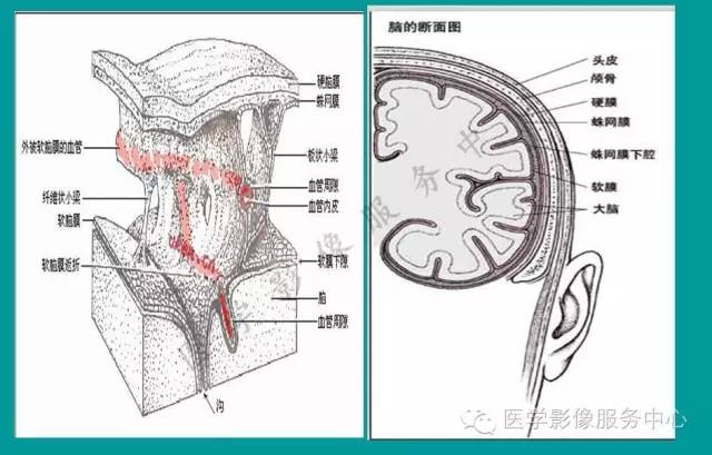 【PPT】蛛网膜颗粒的影像学表现
