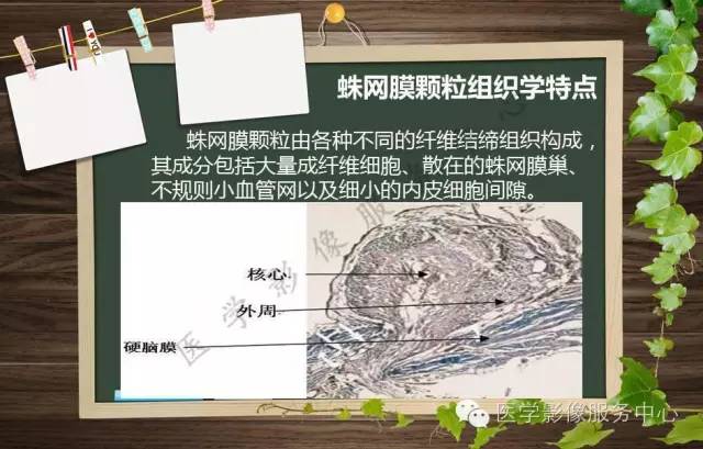 【PPT】蛛网膜颗粒的影像学表现