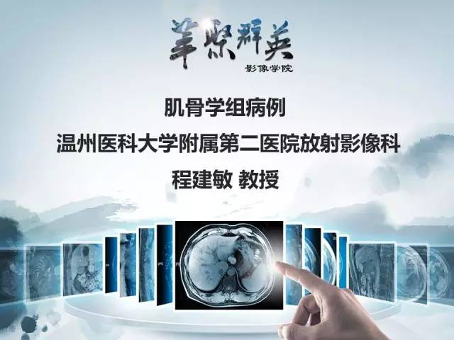 【病例】胫骨高分化骨肉瘤1例X线CT及MR影像表现