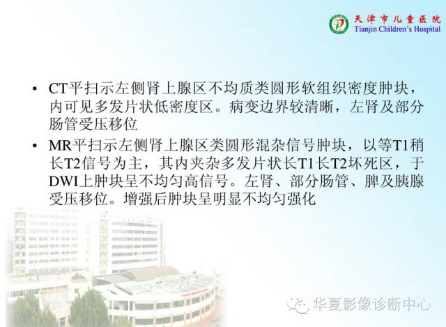 【病例】腹膜后内胚窦瘤1例CT影像表现