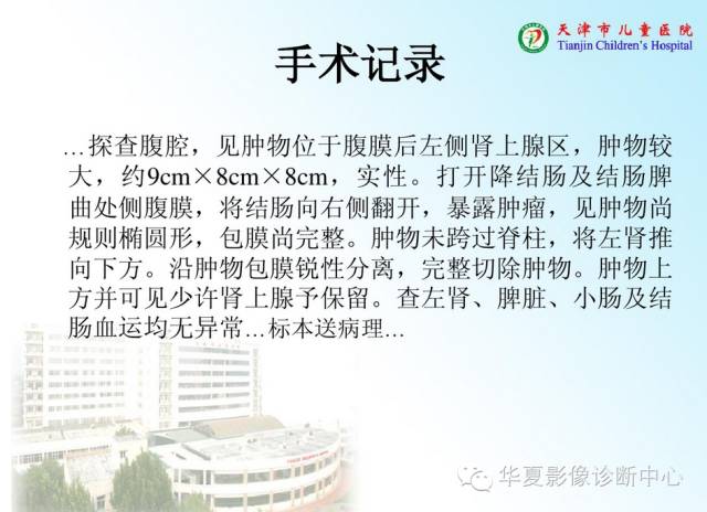 【病例】腹膜后内胚窦瘤1例CT影像表现