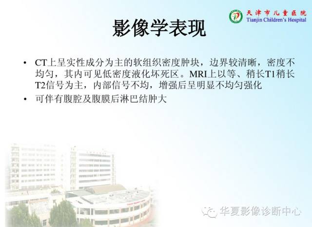 【病例】腹膜后内胚窦瘤1例CT影像表现