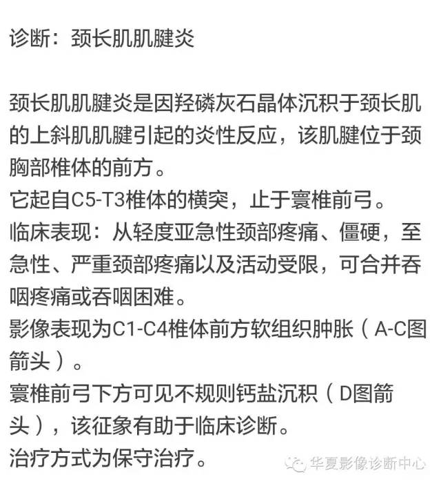 颈长肌肌腱炎