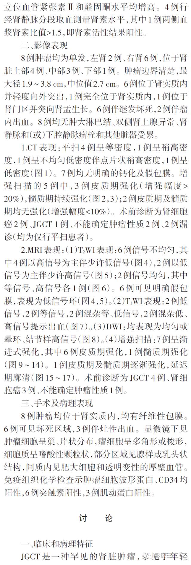肾球旁细胞瘤的CT、MRI表现及临床特征分析