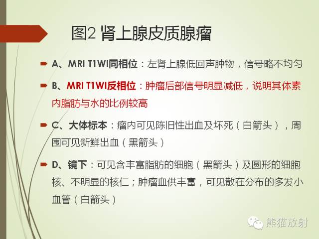 【PPT】成人肾上腺肿瘤及肿瘤样病变影像与病理相关性