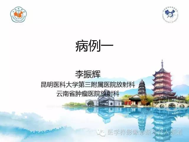 【病例】甲状腺未分化肉瘤1例CT影像表现