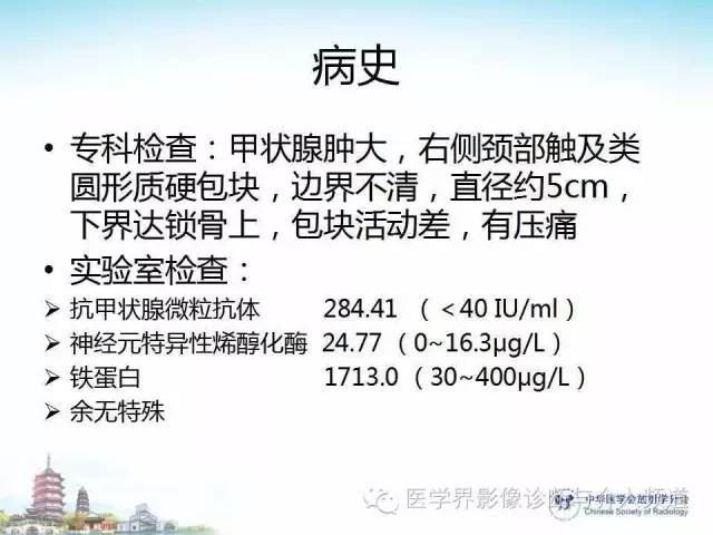 【病例】甲状腺未分化肉瘤1例CT影像表现