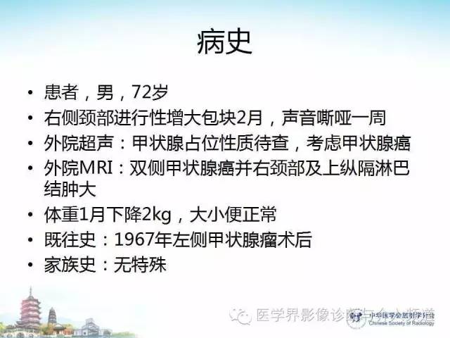 【病例】甲状腺未分化肉瘤1例CT影像表现