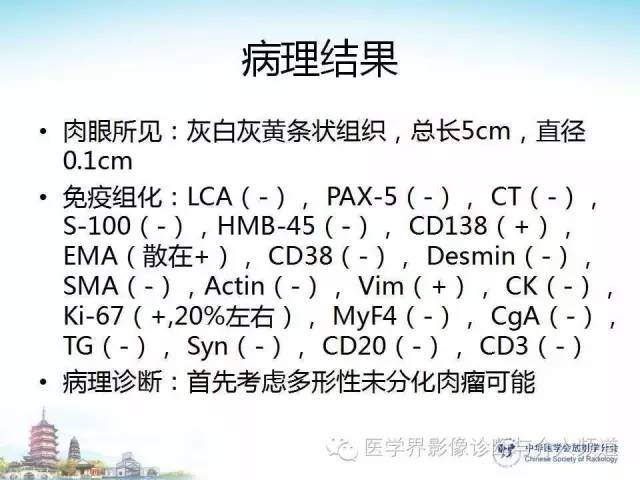 【病例】甲状腺未分化肉瘤1例CT影像表现