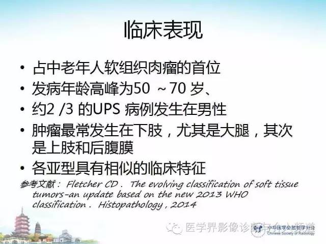 【病例】甲状腺未分化肉瘤1例CT影像表现