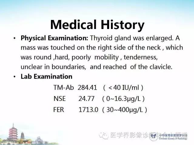 【病例】甲状腺未分化肉瘤1例CT影像表现