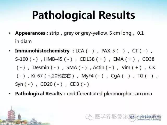 【病例】甲状腺未分化肉瘤1例CT影像表现