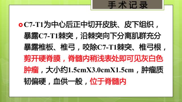 【病例】颈髓髓内孤立性纤维瘤1例MR分析