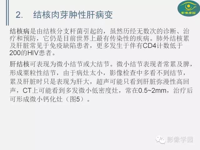 【PPT】肝脏感染性病变影像学鉴别诊断及潜在陷阱
