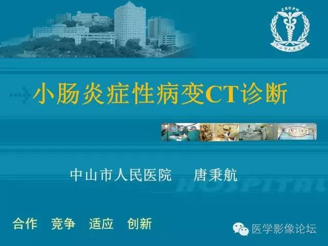 【PPT】小肠炎症性病变CT诊断