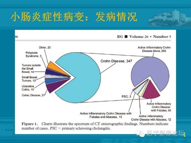 【PPT】小肠炎症性病变CT诊断