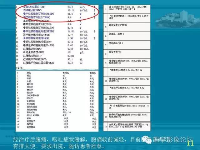 【PPT】小肠炎症性病变CT诊断