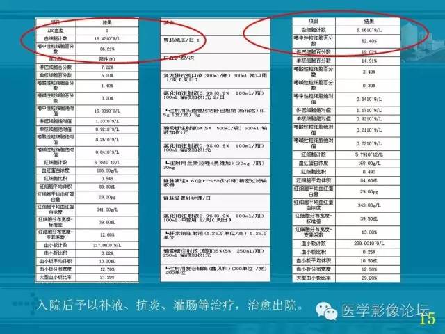 【PPT】小肠炎症性病变CT诊断