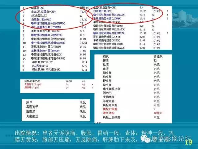 【PPT】小肠炎症性病变CT诊断