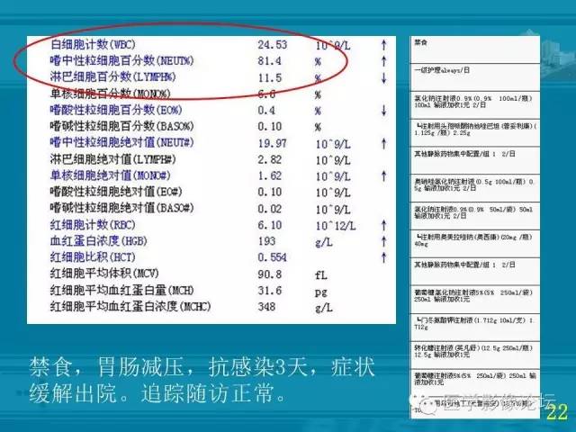 【PPT】小肠炎症性病变CT诊断
