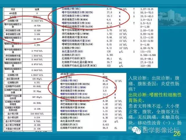 【PPT】小肠炎症性病变CT诊断