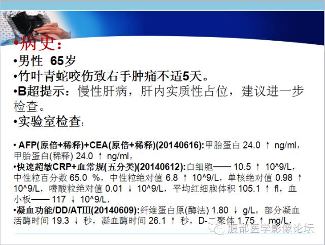 【病例】混合型肝癌1例CT影像征象分析
