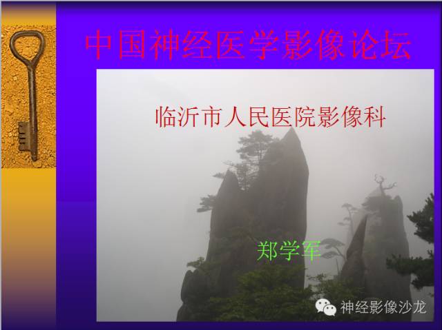 【病例】鞍旁肿瘤三例CT及MR影像表现